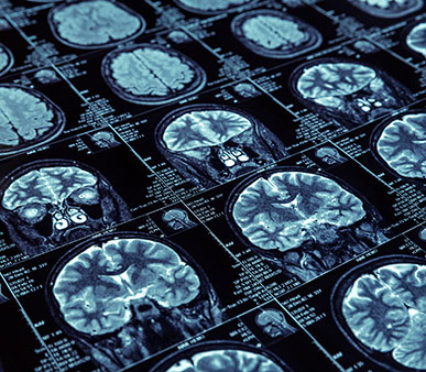 imaging brain scan