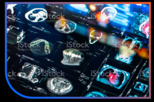 medical imaging scans