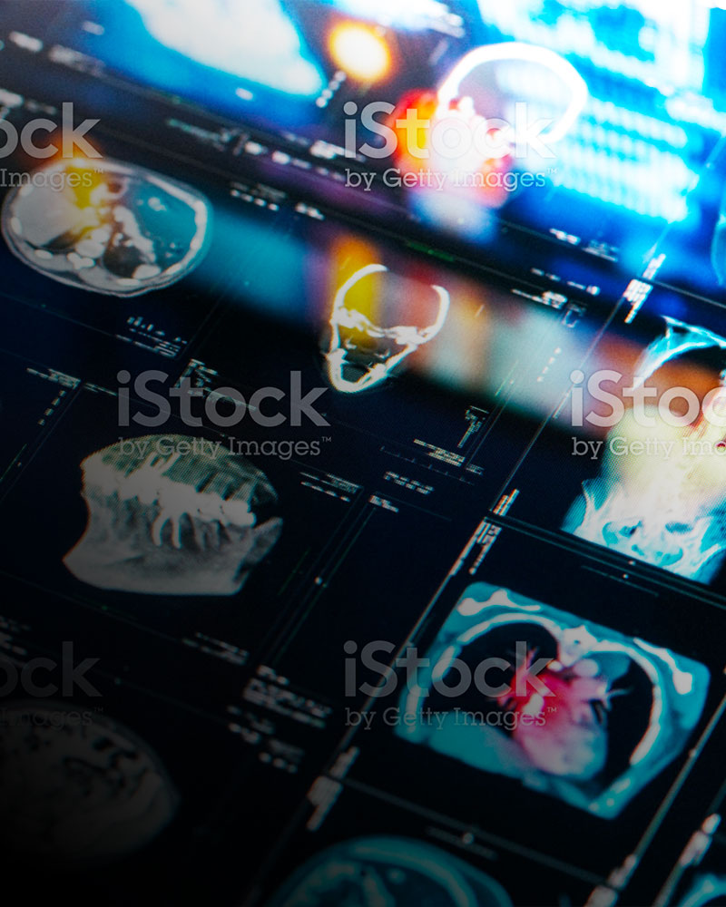 scans